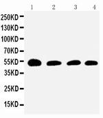 SERPINC1 Polyclonal Antibody