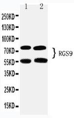 RGS9 Polyclonal Antibody