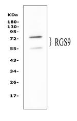RGS9 Antibody in Western Blot (WB)