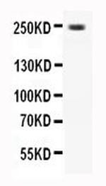 CaV1.3 Polyclonal Antibody