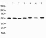 KV1.1 (KCNA1) Polyclonal Antibody