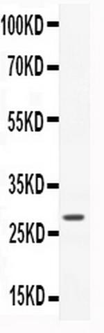 CNTF Antibody in Western Blot (WB)