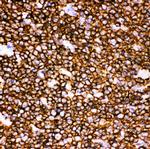 CD20 Antibody in Immunohistochemistry (Paraffin) (IHC (P))