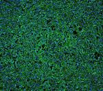 CD20 Antibody in Immunohistochemistry (Paraffin) (IHC (P))