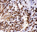 CD20 Antibody in Immunohistochemistry (Paraffin) (IHC (P))