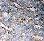 WNT5A Polyclonal Antibody