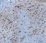 BDNF Polyclonal Antibody