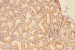 CXCR3 Antibody in Immunohistochemistry (Paraffin) (IHC (P))