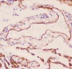COL4A1 Polyclonal Antibody