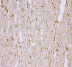 Desmin Antibody in Immunohistochemistry (Frozen) (IHC (F))