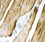 Desmin Antibody in Immunohistochemistry (Paraffin) (IHC (P))