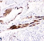 Desmin Antibody in Immunohistochemistry (Paraffin) (IHC (P))