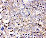 IKK alpha Polyclonal Antibody