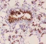 MUC1 Antibody in Immunohistochemistry (Paraffin) (IHC (P))