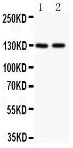 TSC1 Polyclonal Antibody