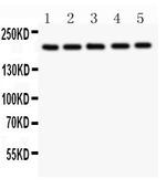 TSC2 Antibody in Western Blot (WB)