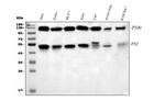 NFkB p52/p100 Antibody in Western Blot (WB)