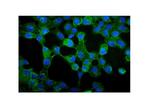 gamma Catenin Polyclonal Antibody