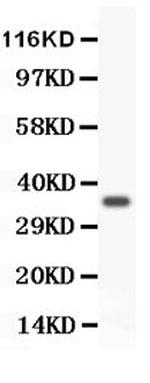 FOXM1 Antibody in Western Blot (WB)