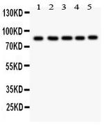 FOXM1 Antibody in Western Blot (WB)