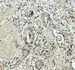 GPX1 Polyclonal Antibody