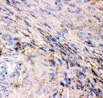 GluR1 Polyclonal Antibody