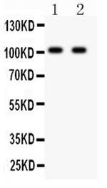 GluR3 Antibody in Western Blot (WB)
