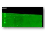 TRPC5 Antibody in Western Blot (WB)
