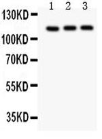 TRPC5 Polyclonal Antibody