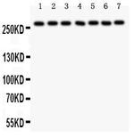 LRRK2 Polyclonal Antibody