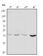PIM1 Polyclonal Antibody