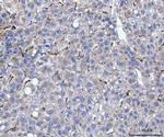 SERPINH1 Antibody in Immunohistochemistry (Paraffin) (IHC (P))