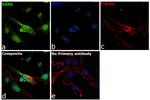 PTCH Antibody in Immunocytochemistry (ICC/IF)