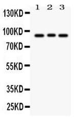 SEMA3A Polyclonal Antibody