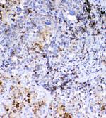 CD36 Polyclonal Antibody