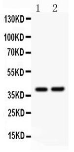 SOX1 Polyclonal Antibody