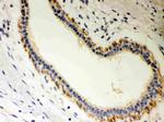 STRAP Polyclonal Antibody