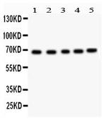 Acetylcholinesterase Polyclonal Antibody