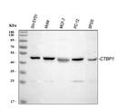 CtBP1 Antibody in Western Blot (WB)