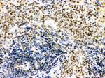 CtBP1 Antibody in Immunohistochemistry (Paraffin) (IHC (P))