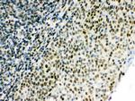 CtBP1 Antibody in Immunohistochemistry (Paraffin) (IHC (P))