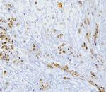 SQSTM1 Antibody in Immunohistochemistry (Frozen) (IHC (F))