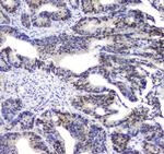 SQSTM1 Antibody in Immunohistochemistry (Paraffin) (IHC (P))
