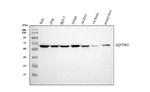 SQSTM1 Antibody in Western Blot (WB)