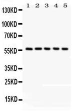 CREB3L1 Polyclonal Antibody