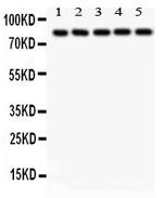SOX5 Polyclonal Antibody