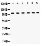 TRPV5 Polyclonal Antibody