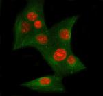 Ku70 Polyclonal Antibody