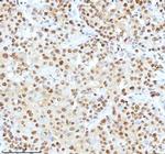 Ku70 Antibody in Immunohistochemistry (Paraffin) (IHC (P))
