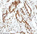 Ku70 Antibody in Immunohistochemistry (Paraffin) (IHC (P))